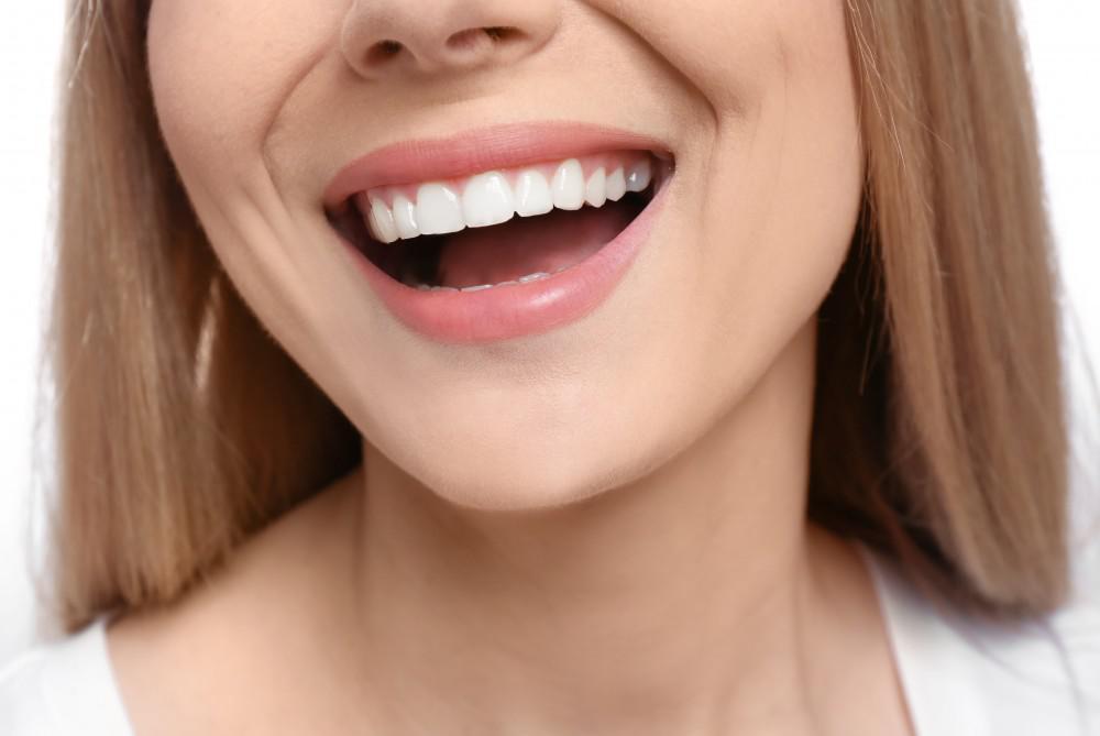 How Lumineers Veneers Transform Smiles Gently and Naturally